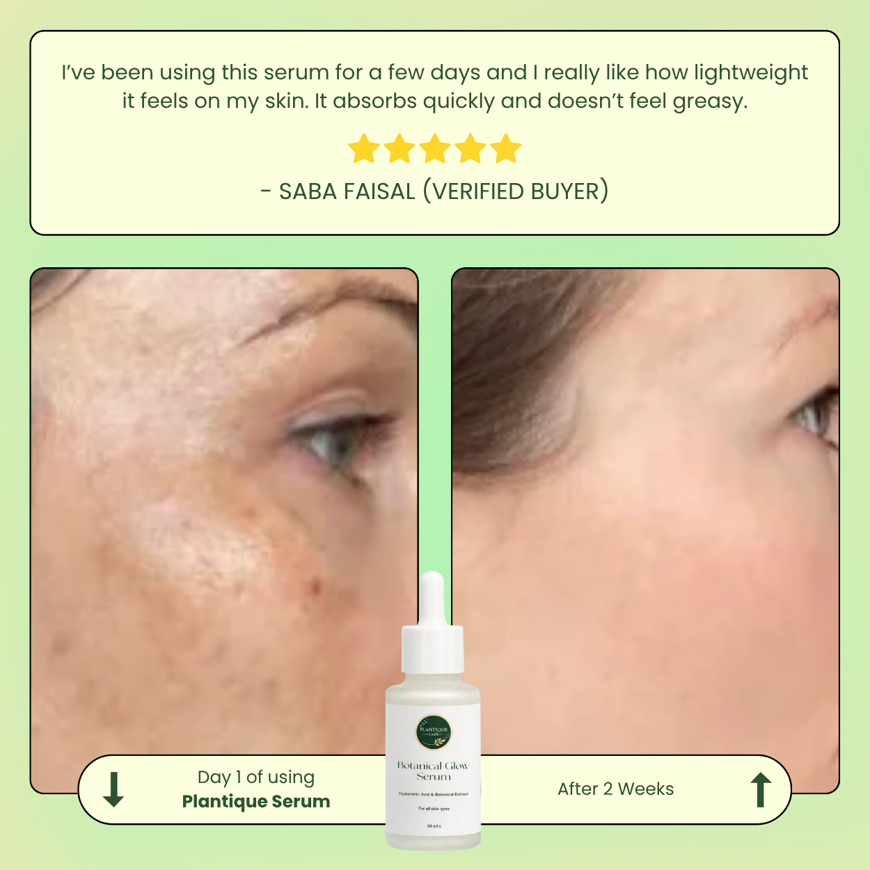 Botanical Glow Serum                       Say Goodbye to Acne & Oily Skin – Without Any Greasy Feel