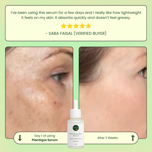 Botanical Glow Serum                       Say Goodbye to Acne & Oily Skin – Without Any Greasy Feel